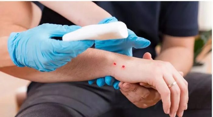 tsimpima dagkoma disi enromo zoo