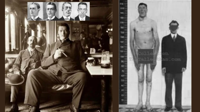 increible historia adam rainer unico ser humano ha padecido enanismo gigantismo 3287889