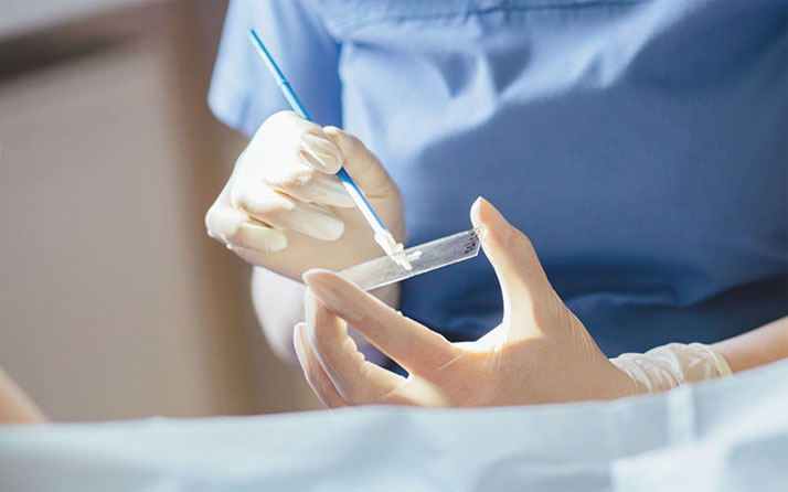pap test παπ τεστ
